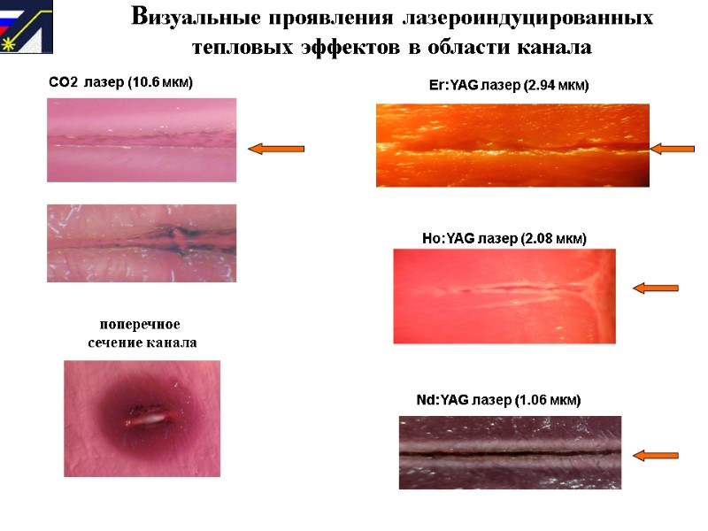 Визуальные проявления лазероиндуцированных тепловых эффектов в области канала      